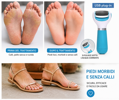 Lima Per Calli Elettrico